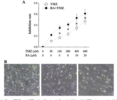 Figure 1 From All Trans Retinoic Acid Enhances Temozolomide Induced