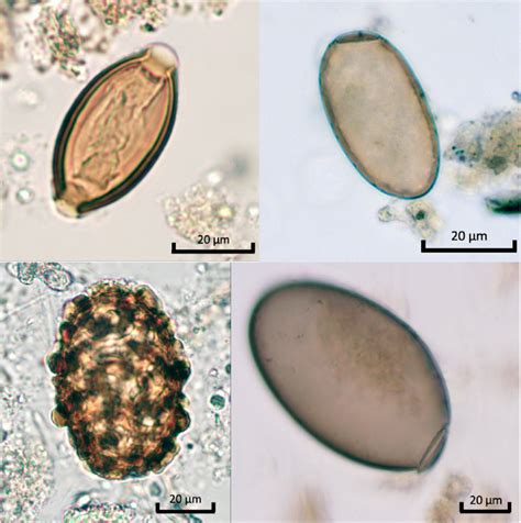 Parasite eggs from the cesspits at Aalst. Top left whipworm (dimensions ...