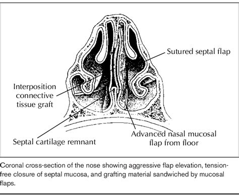 Axial Section Through Nasal Cavity Download Scientific Diagram