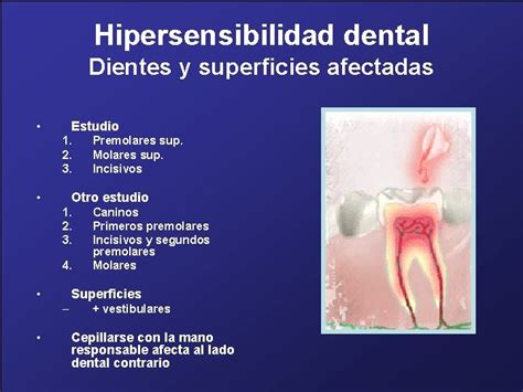 PREVALENCIA DE LA HIPERSENSIBILIDAD DENTAL EN LA CLINICA