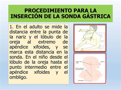 Procedimiento De Lavado Gastrico Ppt