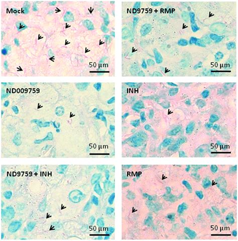 Acid Fast Staining Of Lung Sections From M Tuberculosis Infected Download Scientific Diagram