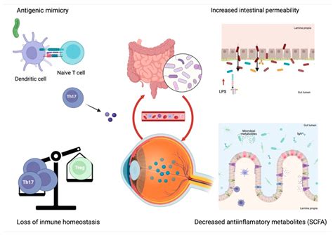 Ijms Free Full Text Microbiome In Immune Mediated Uveitis