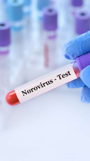 Infecția cu norovirus simptome tratament prevenție