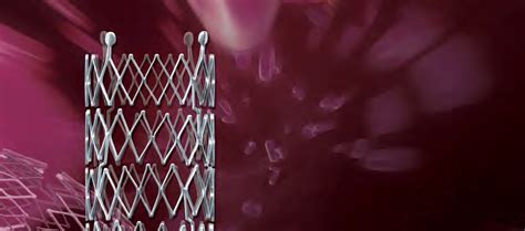 Optimed Sinus Venous Stent Lemare