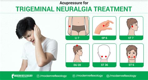 Trigeminal Neuralgia Trigger Points