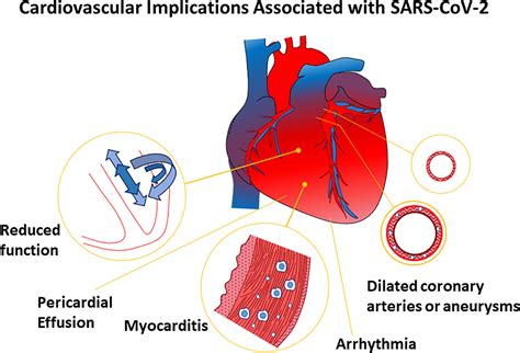 Sars Cov Infection And Associated Cardiovascular Manifestations And