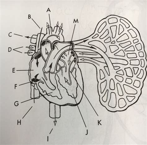 Vascular Cardiac And Interventional Radiography Flashcards Quizlet