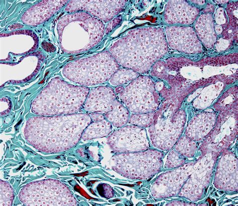 Sebaceous Gland Light Micrograph Stock Image C0586376 Science