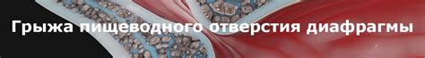 ГПОД | FDMClinic.com