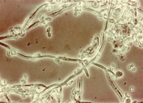 Yeast And Yeast Like Organisms Flashcards Quizlet