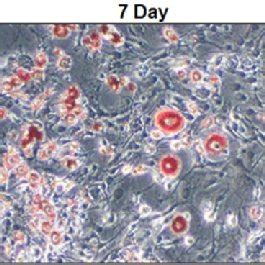 Differentiation Of Preadipocyte Cells 3T3 L1 To Adipocyte Cells