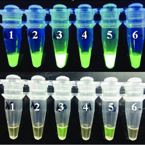 Visual Detection Of LAMP Through A UV Fluorescence And B Naked Eye