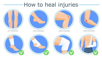 Ways Of Healing Different Skin Burn Injuries Vector Image