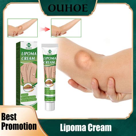 Ouhoe Lipoma Fat Lump Removal Cream Relief Pain Treat Skin Swelling