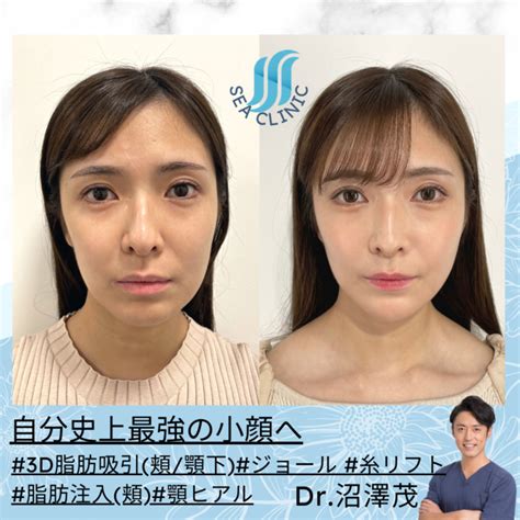 自分史上最強の小顔へ Sea Clinic −シークリニック 銀座― 理想を叶える小顔治療