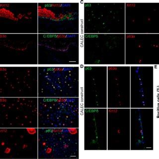 Expression Of Stem Cell Markers In Calec Constructs A Detection Of