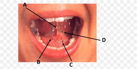 Sublingual Papilla Jaw Close Up Sublingual Gland Png X Px