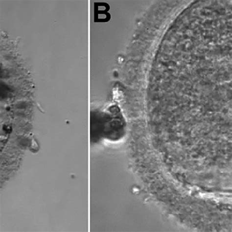 A Oocyte In Metaphase II B Oocyte MII Fertilized With 04 Pronuclei