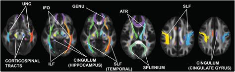 Regions Of Interest ROIs Examined In This Study These ROIs Were