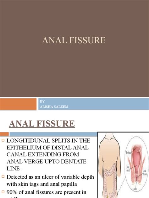 Understanding Anal Fissures Causes Symptoms Treatment And