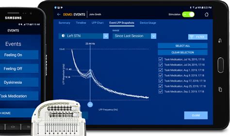 Medtronic Recibe La Aprobaci N Del Marcado Ce Para Su Sistema De