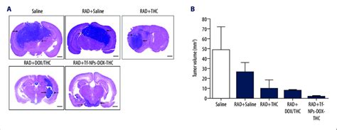 The Anti Tumor Efficacy Of Various Treatments In Nude Mice Bearing