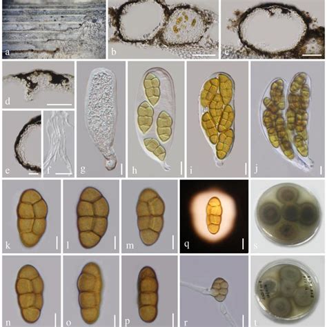 Pdf Novel Fungal Species Of Phaeosphaeriaceae With An Asexualsexual