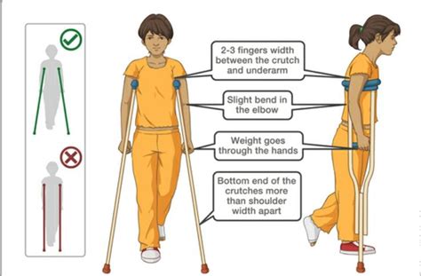 How To Use Crutches 9 Steps With Pictures Wikihow Crutches