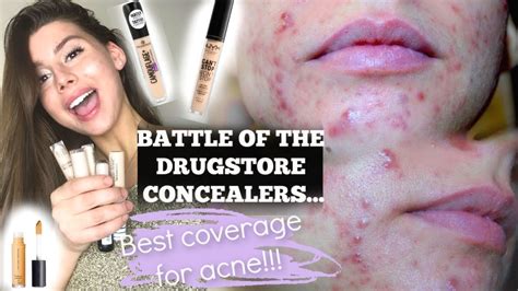 The Best Acne Coverage Concealer In The Drugstore The Winner Is