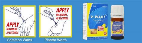 Buy V Wart Remover Liquid Rapidly Eliminates Both Plantar And Common