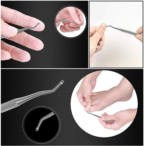 Ingrown Toenail Straightening Clip Curved Bs Brace Toenails Thick