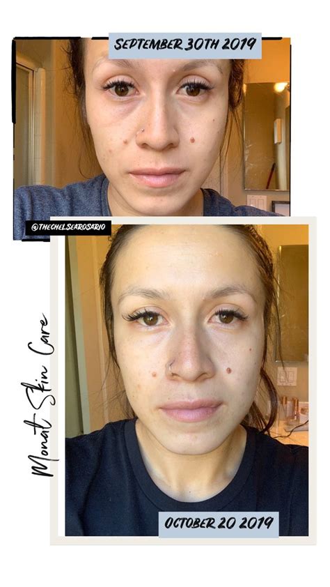 Monat Skin Care Line Be Balance In 2020 Anti Aging Skin Products