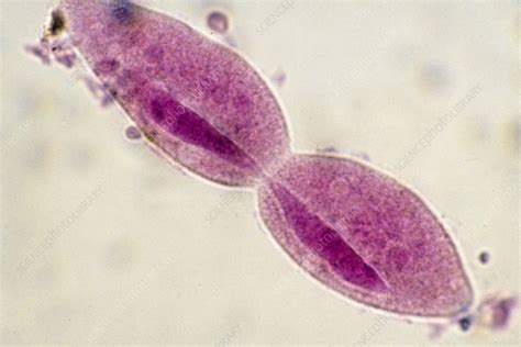 Paramecium Slide Labeled