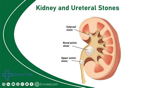 Most Common Urology Diseases