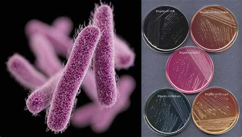 Laboratory Diagnosis Treatment And Prevention Of Shigella Dysenteriae