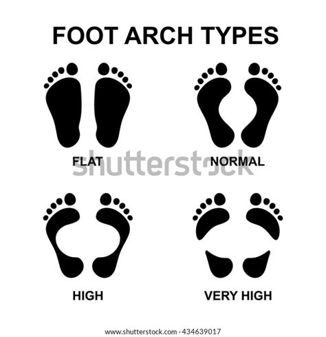 Foot Arch Types Vector Infographics Set Stock Vector (Royalty Free ...