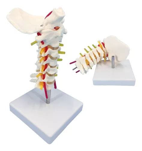 Veipho Modelo De Columna Cervical Con Nervios Columna Verte Cuotas