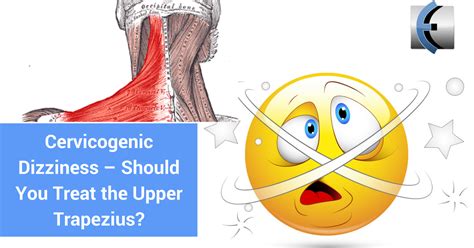 Cervicogenic Dizziness – Should You Treat the Upper Trapezius? | Modern ...