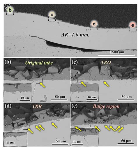 Cross sectional morphologies of different regions in IBD with ΔR 1 0