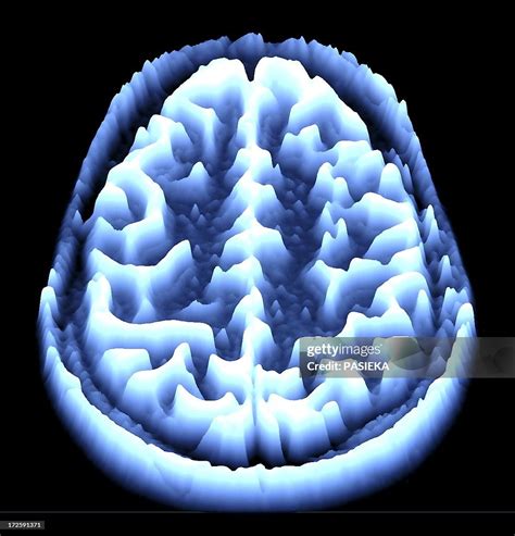 Brain Scan Mri Scan Heightmap High Res Stock Photo Getty Images