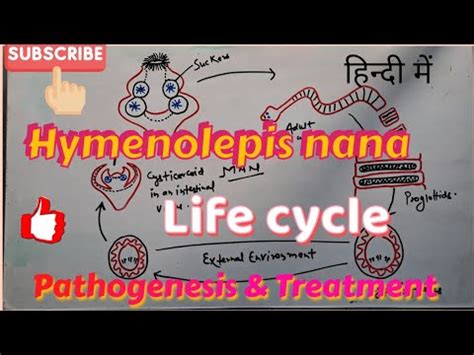 Hymenolepis Nana Life Cycle Clinical Symptoms Treatment In Hindi