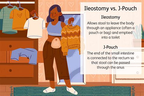 Ileostomy J Pouch