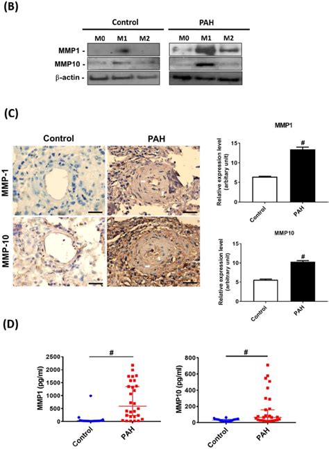 Increased Expression Levels Of Mmp And Mmp In Pah Patients A