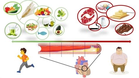 The Role Of Nutrition In Cardiovascular Disease Current Concepts And