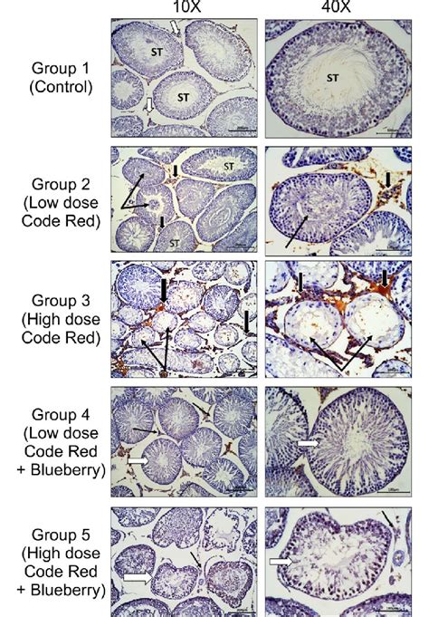 Sections From Rat Testis Immunostained For Caspase 3 Apoptotic Marker