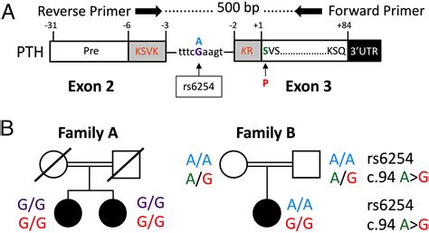 Homozygous Ser 1 To Pro 1 Mutation In Parathyroid Hormone Identified In