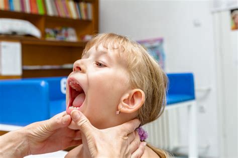 Togliere Le Tonsille In Sette Casi Su Otto Si Potrebbe Evitare