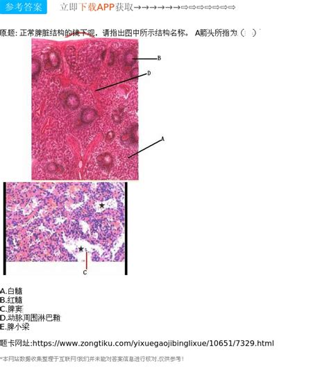 脾白髓由哪些结构组成,脾的组织结构 - 伤感说说吧