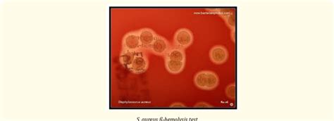 Beta-hemolytic (β-hemolysis), of Staphylococcus aureus colonies on ...